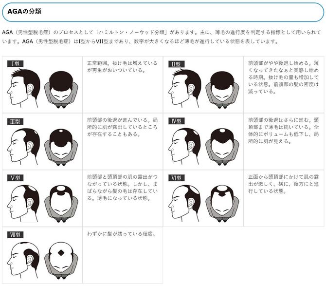 奈良のAGA（男性型脱毛症）ご相談はピュアメンズクリニック　男性専門美容外科